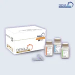 تصویر کیت استخراج از ژل دنازیست با نام تجاری جدید DENAzist Gel-Max-Extract Kit جهت جداسازی و بازیابی سریع و ساده اسیدهای نوکلئیک از ژل آگارز